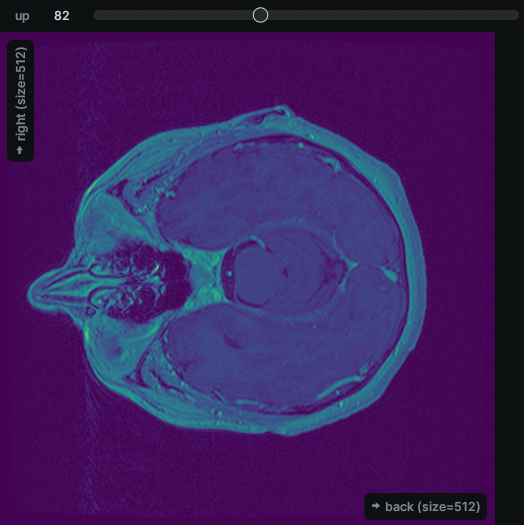 dicom example>
