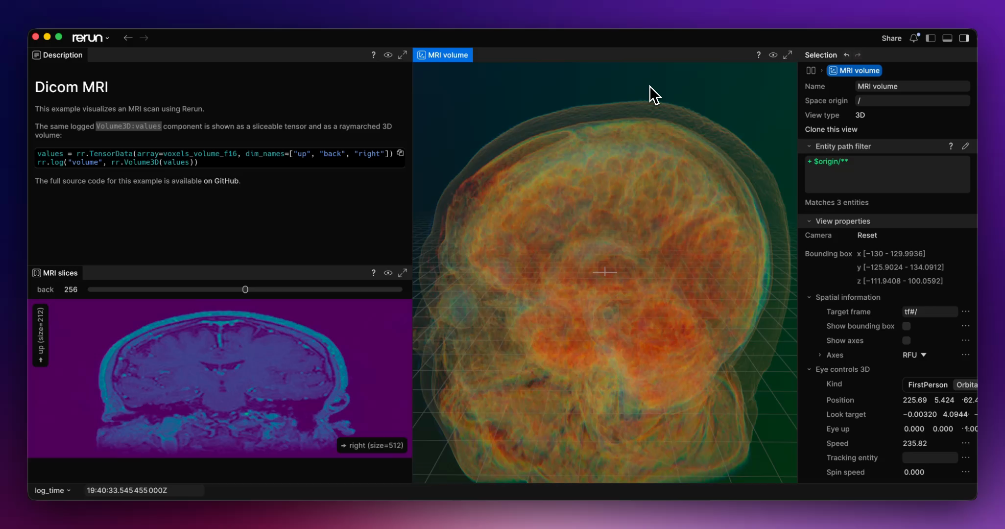 MRI scan rendered as a raymarched 3D volume